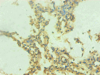 Immunohistochemical of paraffin-embedded human lung tissue using CSB-MA0206421A0m at dilution of 1:200 Immunohistochemical of paraffin-embedded human lung tissue using CSB-MA0206421A0m at dilution of 1:200