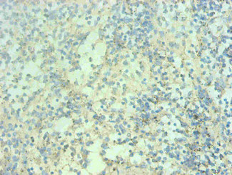 Immunohistochemical of paraffin-embedded human spleen tissue using CSB-MA0206421A0m at dilution of 1:200