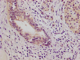 anti-Homo sapiens (Human) NFE2L2 Monoclonal Antibody raised in