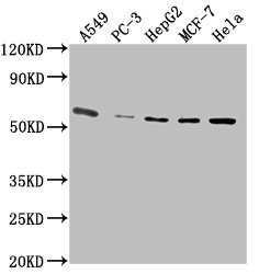 PD-L1 Monoclonal Antibody- CUSABIO