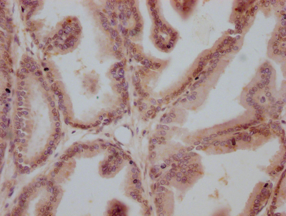 CSB-MA999605-IHC-1