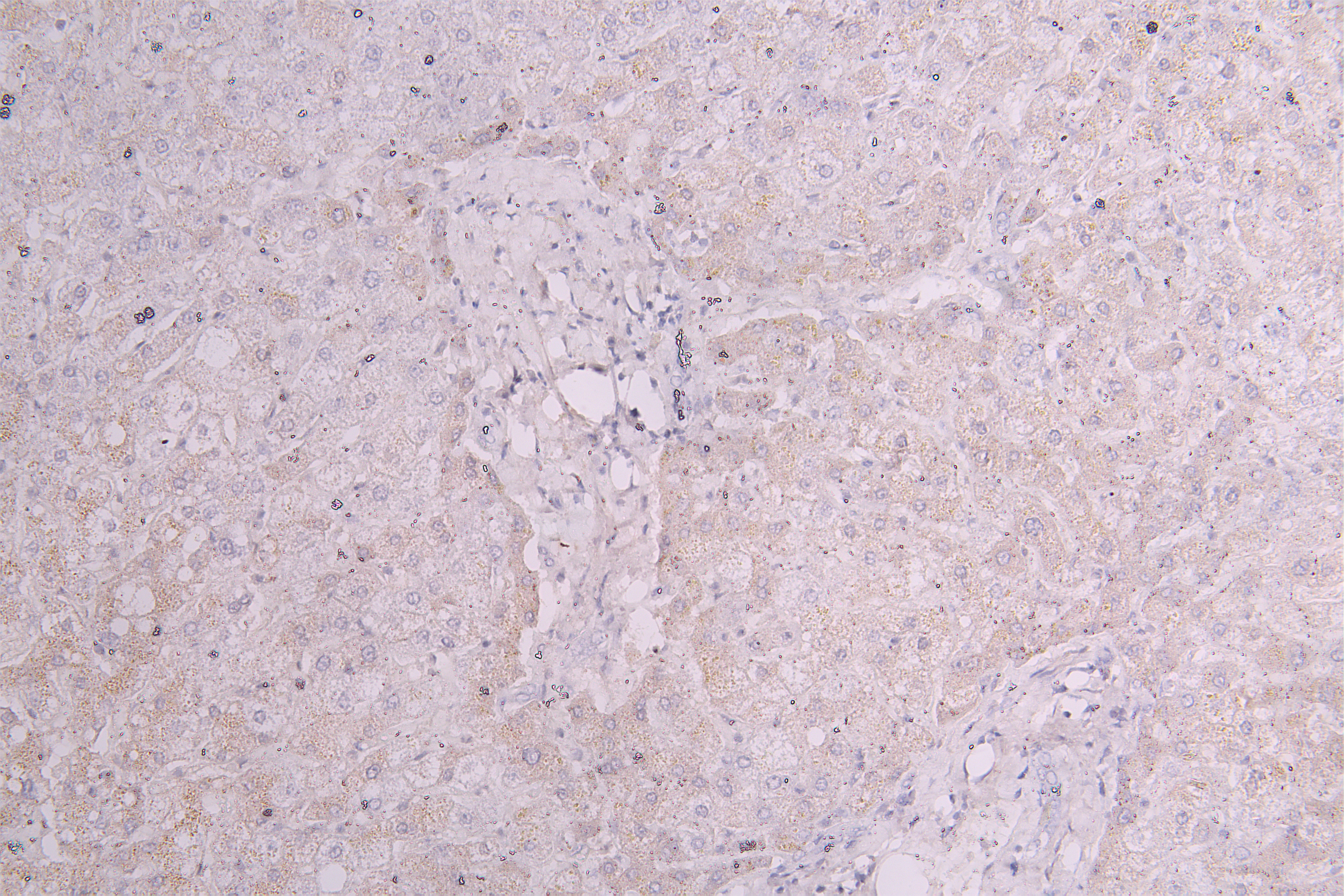 CSB-RA003657MA1HU