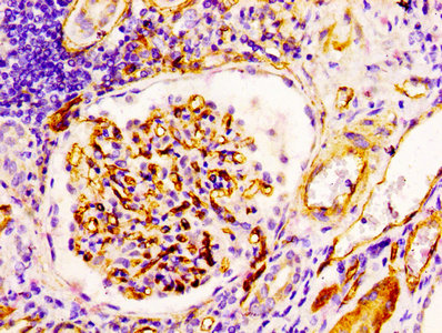 IHC image of CSB-RA004926A0HU diluted at 1:100 and staining in paraffin-embedded human kidney tissue performed on a Leica BondTM system. After dewaxing and hydration, antigen retrieval was mediated by high pressure in a citrate buffer (pH 6.0). Section was blocked with 10% normal goat serum 30min at RT. Then primary antibody (1% BSA) was incubated at 4°C overnight. The primary is detected by a biotinylated secondary antibody and visualized using an HRP conjugated SP system. IHC image of CSB-RA004926A0HU diluted at 1:100 and staining in paraffin-embedded human kidney tissue performed on a Leica BondTM system. After dewaxing and hydration, antigen retrieval was mediated by high pressure in a citrate buffer (pH 6.0). Section was blocked with 10% normal goat serum 30min at RT. Then primary antibody (1% BSA) was incubated at 4°C overnight. The primary is detected by a biotinylated secondary antibody and visualized using an HRP conjugated SP system.