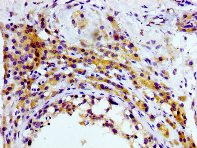 CSB-RA004960A0HU IHC-2