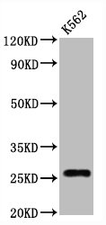 CSB-RA004960A0HU WB