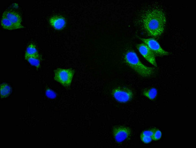 Immunofluorescence staining of MCF-7 cells with CSB-RA004969A0HU at 1:34,counter-stained with DAPI. The cells were fixed in 4% formaldehyde, permeabilized using 0.2% Triton X-100 and blocked in 10% normal Goat Serum. The cells were then incubated with the antibody overnight at 4°C.The secondary antibody was Alexa Fluor 488-congugated AffiniPure Goat Anti-Rabbit IgG (H+L).