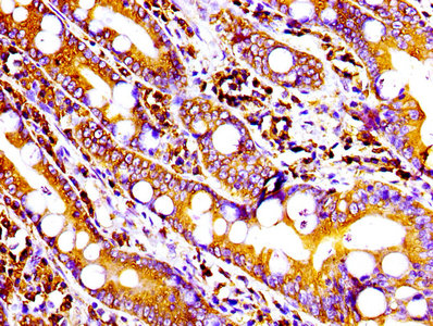 IHC image of CSB-RA004969A0HU diluted at 1:100 and staining in paraffin-embedded human small intestine tissue performed on a Leica BondTM system. After dewaxing and hydration, antigen retrieval was mediated by high pressure in a citrate buffer (pH 6.0). Section was blocked with 10% normal goat serum 30min at RT. Then primary antibody (1% BSA) was incubated at 4°C overnight. The primary is detected by a biotinylated secondary antibody and visualized using an HRP conjugated SP system.