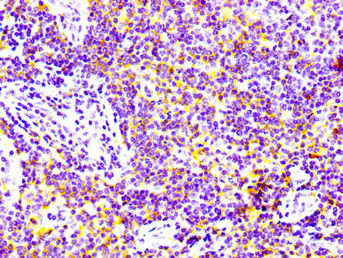CSB-RA004972A0HU