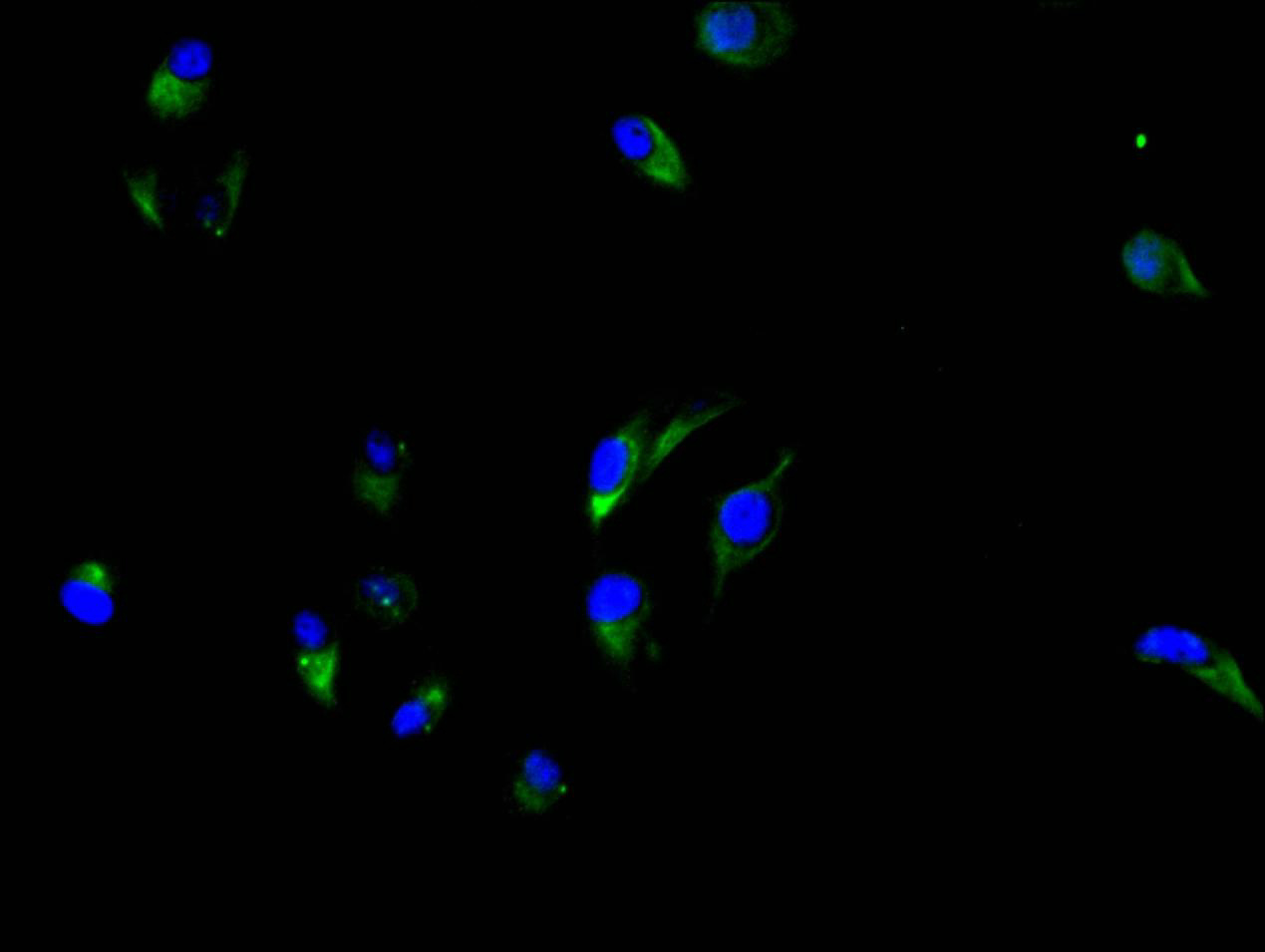 CSB-RA005165MA3HU