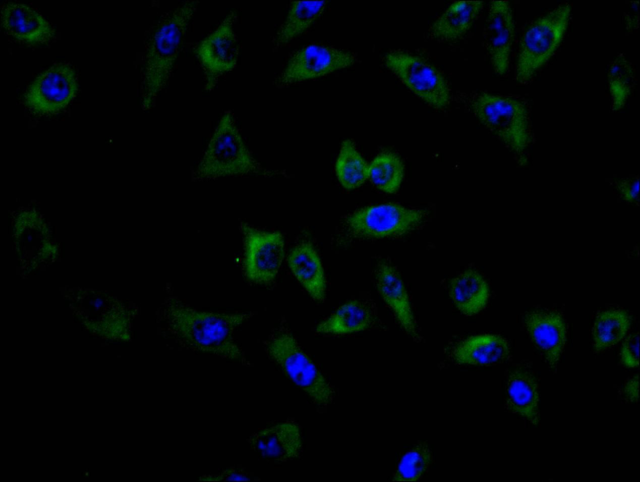 CSB-RA005165MA3HU