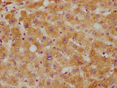 CSB-RA005267A0HU