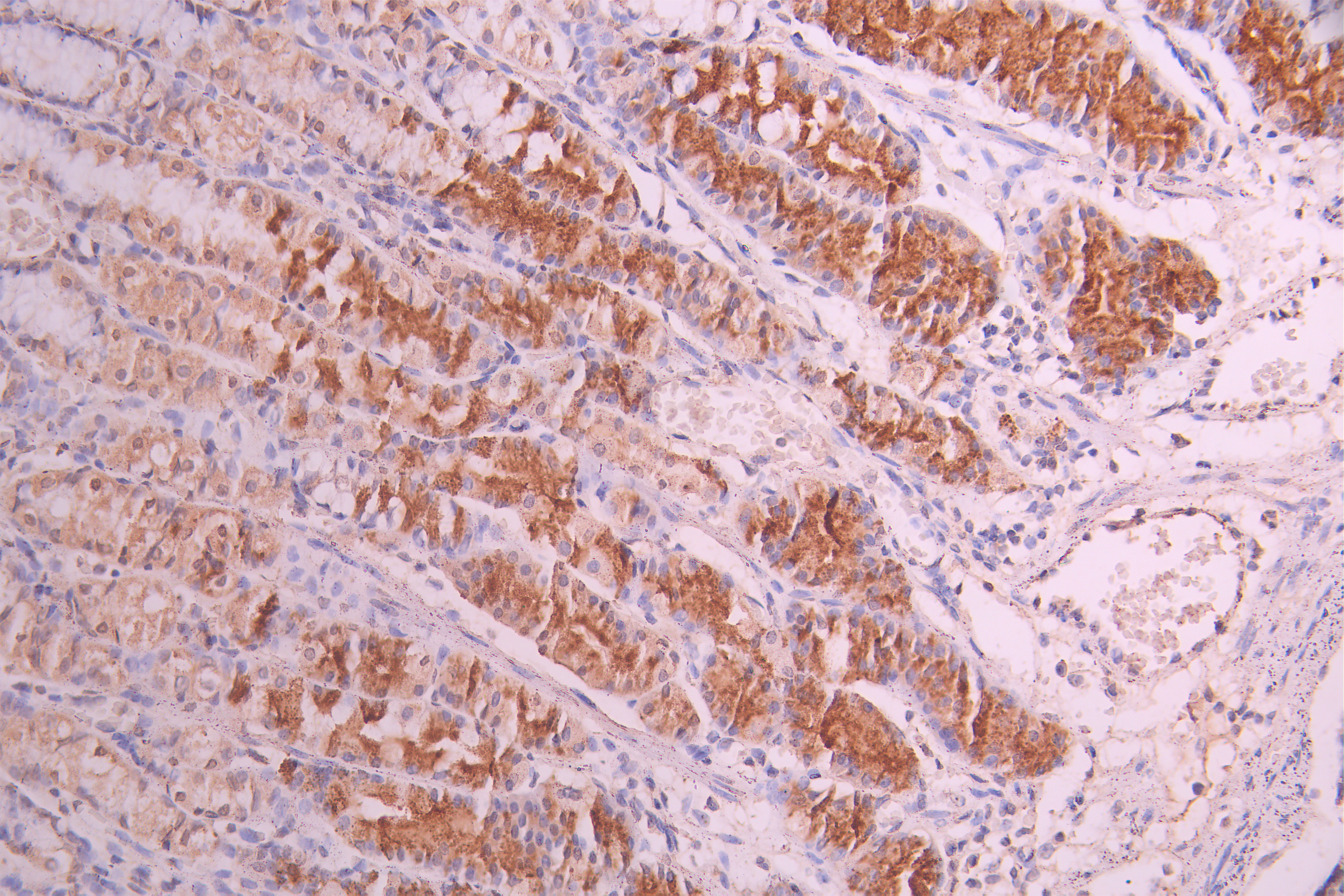 CSB-RA005621MA1HU