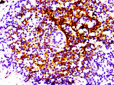 CSB-RA005934A0HU-IHC-2