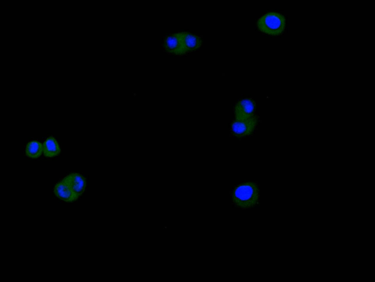 CTNNB1 Recombinant Monoclonal Antibody - image 3
