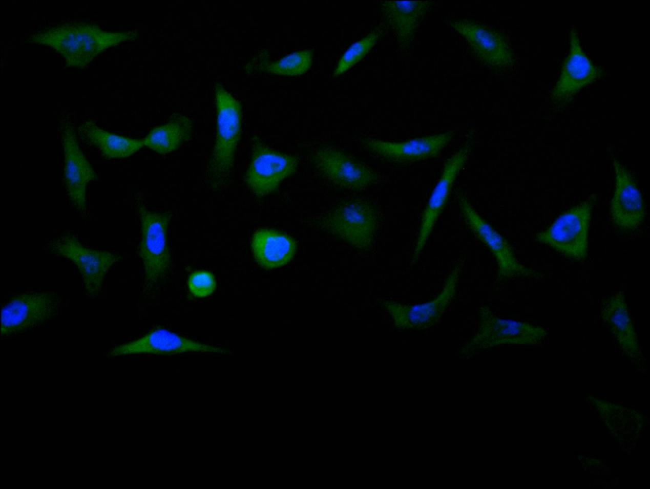 CTNNB1 Recombinant Monoclonal Antibody - image 4