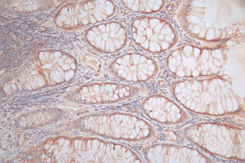 CTNNB1 Recombinant Monoclonal Antibody - image 2