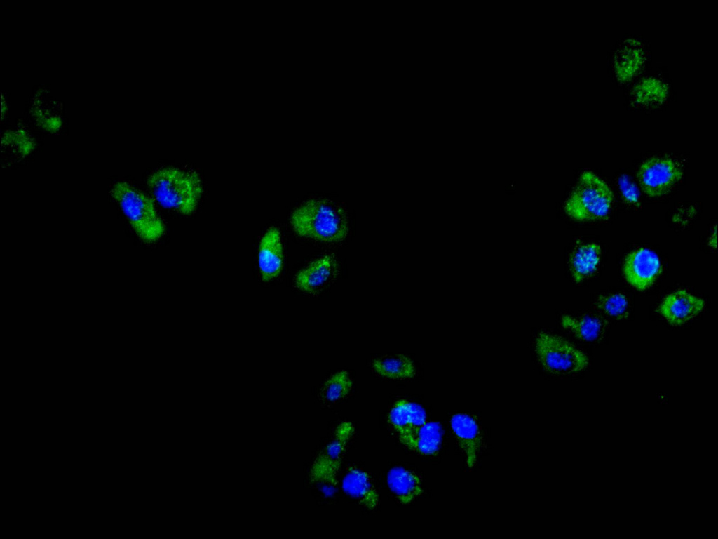 CSB-RA006325MA1HU