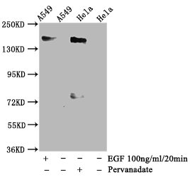 Western Blot Positive WB detected in A549 whole cell lysate,Hela whole cell lysate(treated with Pervanadate or EGF) All lanes Phospho-EGFR antibody at 1.35microg/ml Secondary Goat polyclonal to rabbit IgG at 1/50000 dilution Predicted band size: 170 KDa Observed band size: 170 KDa Western Blot Positive WB detected in A549 whole cell lysate,Hela whole cell lysate(treated with Pervanadate or EGF) All lanes Phospho-EGFR antibody at 1.35microg/ml Secondary Goat polyclonal to rabbit IgG at 1/50000 dilution Predicted band size: 170 KDa Observed band size: 170 KDa