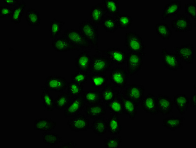 Immunofluorescence staining of Hela cells(treated with 50mM Calyculin A for 30min) with CSB-RA007511A446phHU at 1:100,counter-stained with DAPI. The cells were fixed in 4% formaldehyde, permeabilized using 0.2% Triton X-100 and blocked in 10% normal Goat Serum. The cells were then incubated with the antibody overnight at 4°C. The secondary antibody was Alexa Fluor 488-congugated AffiniPure Goat Anti-Rabbit IgG (H+L).