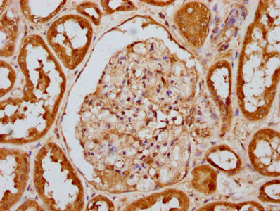 IHC image of CSB-RA007511A446phHU diluted at 1:100 and staining in paraffin-embedded human kidney tissue performed on a Leica BondTM system. After dewaxing and hydration, antigen retrieval was mediated by high pressure in a citrate buffer (pH 6.0). Section was blocked with 10% normal goat serum 30min at RT. Then primary antibody (1% BSA) was incubated at 4°C overnight. The primary is detected by a biotinylated secondary antibody and visualized using an HRP conjugated SP system.