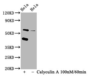 Western Blot Positive WB detected in Hela whole cell lysate(treated with Calyculin A or not) All lanes Phospho-EIF2AK2 antibody at 1.25microg/ml Secondary Goat polyclonal to rabbit IgG at 1/50000 dilution Predicted band size: 62 KDa Observed band size: 62 KDa Western Blot Positive WB detected in Hela whole cell lysate(treated with Calyculin A or not) All lanes Phospho-EIF2AK2 antibody at 1.25microg/ml Secondary Goat polyclonal to rabbit IgG at 1/50000 dilution Predicted band size: 62 KDa Observed band size: 62 KDa