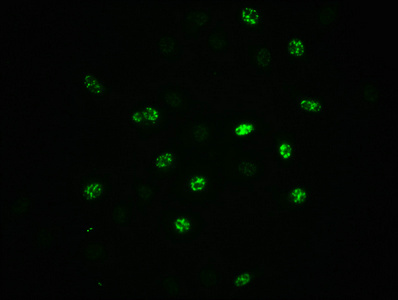 Immunofluorescence staining of A549 cells(treated with 100ng/ml EGF for 20min) with CSB-RA007523A51phHU at 1:100,counter-stained with DAPI. The cells were fixed in 4% formaldehyde, permeabilized using 0.2% Triton X-100 and blocked in 10% normal Goat Serum. The cells were then incubated with the antibody overnight at 4°C. The secondary antibody was Alexa Fluor 488-congugated AffiniPure Goat Anti-Rabbit IgG (H+L).
