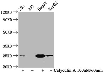 Western Blot Positive WB detected in 293 whole cell lysate,HepG2 whole cell lysate(treated with Calyculin A or not) All lanes Phospho-EIF4E antibody at 1.2microg/ml Secondary Goat polyclonal to rabbit IgG at 1/50000 dilution Predicted band size: 25 KDa Observed band size: 25 KDa Western Blot Positive WB detected in 293 whole cell lysate,HepG2 whole cell lysate(treated with Calyculin A or not) All lanes Phospho-EIF4E antibody at 1.2microg/ml Secondary Goat polyclonal to rabbit IgG at 1/50000 dilution Predicted band size: 25 KDa Observed band size: 25 KDa