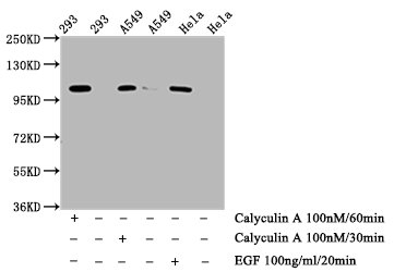 CSB-RA007795A724phHU-WB