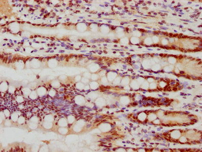 IHC image of CSB-RA008585A0HU diluted at 1:77.5 and staining in paraffin-embedded human small intestine tissue performed on a Leica BondTM system. After dewaxing and hydration, antigen retrieval was mediated by high pressure in a citrate buffer (pH 6.0). Section was blocked with 10% normal goat serum 30min at RT. Then primary antibody (1% BSA) was incubated at 4°C overnight. The primary is detected by a biotinylated secondary antibody and visualized using an HRP conjugated SP system.