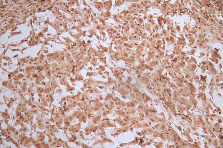 FTH1 Recombinant Monoclonal Antibody - image 2