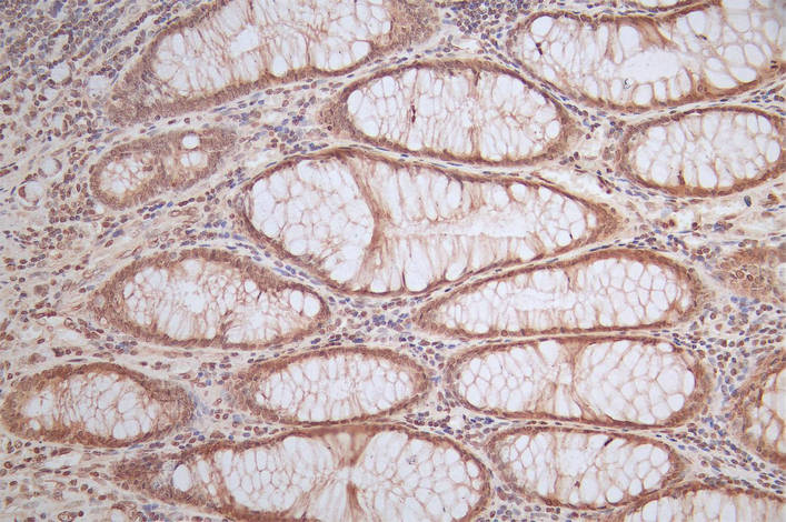 FTH1 Recombinant Monoclonal Antibody - image 3