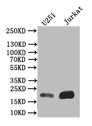 CSB-RA009030MA1HU WB