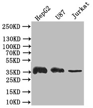 CSB-RA009232MA1HU WB