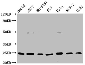 Western Blot Positive WB detected in: HepG2 whole cell lysate, 293T whole cell lysate, SH-SY5Y whole cell lysate, PC3 whole cell lysate, Hela whole cell lysate, MCF-7 whole cell lysate, U251 whole cell lysate All lanes: GDNF antibody at 1microg/ml Secondary Goat polyclonal to rabbit IgG at 1/50000 dilution Predicted band size: 24, 21, 26, 23, 19 KDa Observed band size: 24 KDa Western Blot Positive WB detected in: HepG2 whole cell lysate, 293T whole cell lysate, SH-SY5Y whole cell lysate, PC3 whole cell lysate, Hela whole cell lysate, MCF-7 whole cell lysate, U251 whole cell lysate All lanes: GDNF antibody at 1microg/ml Secondary Goat polyclonal to rabbit IgG at 1/50000 dilution Predicted band size: 24, 21, 26, 23, 19 KDa Observed band size: 24 KDa