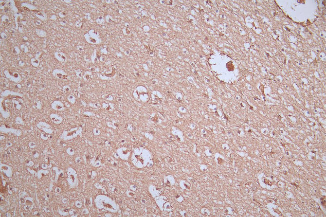 CSB-RA009369MA1HU IHC