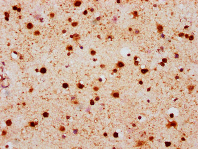 Phospho-Histone H2AX (S139) Recombinant Monoclonal Antibody - image 2