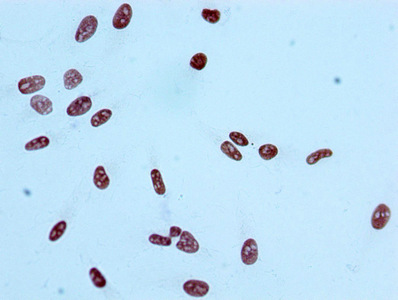 Immunocytochemistry analysis of CSB-RA010385A09acHU diluted at 1:100 and staining in Hela cells performed on a Leica BondTM system. After dewaxing and hydration, antigen retrieval was mediated by high pressure in a citrate buffer (pH 6.0). Section was blocked with 10% normal goat serum 30min at RT. Then primary antibody (1% BSA) was incubated at 4°C overnight. The primary is detected by a biotinylated secondary antibody and visualized using an HRP conjugated SP system. Immunocytochemistry analysis of CSB-RA010385A09acHU diluted at 1:100 and staining in Hela cells performed on a Leica BondTM system. After dewaxing and hydration, antigen retrieval was mediated by high pressure in a citrate buffer (pH 6.0). Section was blocked with 10% normal goat serum 30min at RT. Then primary antibody (1% BSA) was incubated at 4°C overnight. The primary is detected by a biotinylated secondary antibody and visualized using an HRP conjugated SP system.