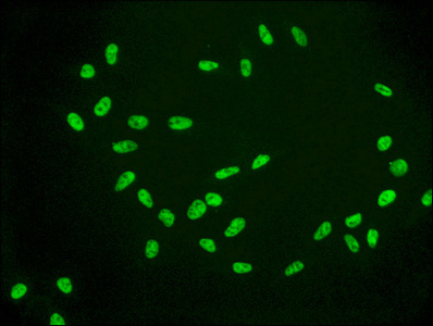 Immunofluorescence staining of Hela cells(treated by 15mM sodium butyrate for 30min) with CSB-RA010385A09acHU at 1:56,counter-stained with DAPI. The cells were fixed in 4% formaldehyde, permeabilized using 0.2% Triton X-100 and blocked in 10% normal Goat Serum. The cells were then incubated with the antibody overnight at 4°C.The secondary antibody was Alexa Fluor 488-congugated AffiniPure Goat Anti-Rabbit IgG (H+L).