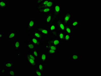Histone H2A type 1-B/E Recombinant Monoclonal Antibody - image 2