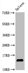 Western Blot Positive WB detected in Mouse spleen tissue All lanes Hydroxyl-Histone H2A type 1-B/E (Y39) antibody at 1.05microg/ml Secondary Goat polyclonal to rabbit IgG at 1/50000 dilution Predicted band size: 14 KDa Observed band size: 14 KDa Western Blot Positive WB detected in Mouse spleen tissue All lanes Hydroxyl-Histone H2A type 1-B/E (Y39) antibody at 1.05microg/ml Secondary Goat polyclonal to rabbit IgG at 1/50000 dilution Predicted band size: 14 KDa Observed band size: 14 KDa