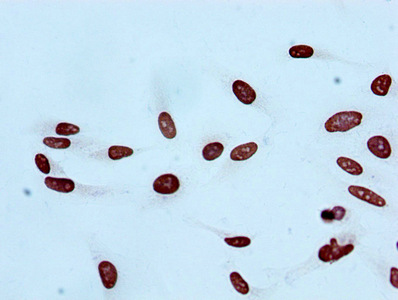 Immunocytochemistry analysis of CSB-RA010402A20acHU diluted at 1:100 and staining in Hela cells performed on a Leica BondTM system. After dewaxing and hydration, antigen retrieval was mediated by high pressure in a citrate buffer (pH 6.0). Section was blocked with 10% normal goat serum 30min at RT. Then primary antibody (1% BSA) was incubated at 4°C overnight. The primary is detected by a biotinylated secondary antibody and visualized using an HRP conjugated SP system.