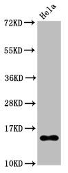 Western Blot Positive WB detected in Hela whole cell lysate treated by 15mM sodium butyrate for 30min All lanes Acetyl-Histone H2B type 1-B(K20)antibody at 0.135microg/ml Secondary Goat polyclonal to rabbit IgG at 1/50000 dilution Predicted band size: 15 KDa Observed band size: 15 KDa Western Blot Positive WB detected in Hela whole cell lysate treated by 15mM sodium butyrate for 30min All lanes Acetyl-Histone H2B type 1-B(K20)antibody at 0.135microg/ml Secondary Goat polyclonal to rabbit IgG at 1/50000 dilution Predicted band size: 15 KDa Observed band size: 15 KDa