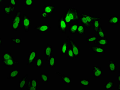 Immunofluorescence staining of Hela cells with CSB-RA010418A02me1HU at 1:60,counter-stained with DAPI. The cells were fixed in 4% formaldehyde, permeabilized using 0.2% Triton X-100 and blocked in 10% normal Goat Serum. The cells were then incubated with the antibody overnight at 4°C.The secondary antibody was Alexa Fluor 488-congugated AffiniPure Goat Anti-Rabbit IgG (H+L).