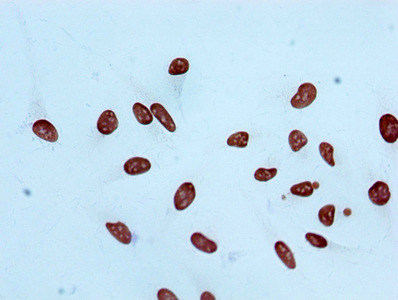 Di-methyl-Histone H3.1 (K4) Recombinant Monoclonal Antibody - image 2