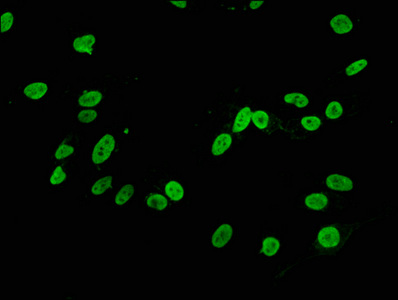 Di-methyl-Histone H3.1 (K4) Recombinant Monoclonal Antibody - image 3