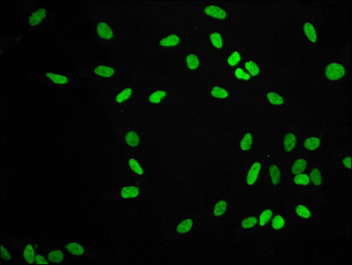 Immunofluorescence staining of Hela cells with CSB-RA010418A09me2HU at 1:56,counter-stained with DAPI. The cells were fixed in 4% formaldehyde, permeabilized using 0.2% Triton X-100 and blocked in 10% normal Goat Serum. The cells were then incubated with the antibody overnight at 4°C.The secondary antibody was Alexa Fluor 488-congugated AffiniPure Goat Anti-Rabbit IgG (H+L).