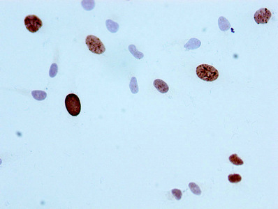 Phospho-Histone H3.1 (S10) Recombinant Monoclonal Antibody - image 2
