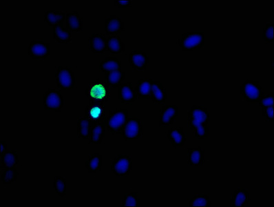 Phospho-Histone H3.1 (S10) Recombinant Monoclonal Antibody - image 3