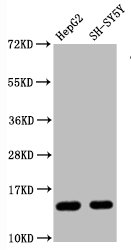 Western Blot Positive WB detected in HepG2 whole cell lysateH-SY5Y whole cell lysate All lanes Mono-methyl-Histone H3.1(R128)antibody at 0.87microg/ml Secondary Goat polyclonal to rabbit IgG at 1/50000 dilution Predicted band size: 15 KDa Observed band size: 15 KDa Western Blot Positive WB detected in HepG2 whole cell lysateH-SY5Y whole cell lysate All lanes Mono-methyl-Histone H3.1(R128)antibody at 0.87microg/ml Secondary Goat polyclonal to rabbit IgG at 1/50000 dilution Predicted band size: 15 KDa Observed band size: 15 KDa