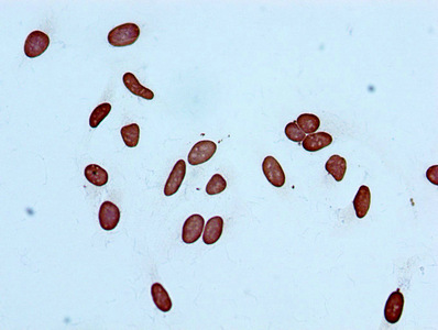 Immunocytochemistry analysis of CSB-RA010418A14acHU diluted at 1:100 and staining in Hela cells performed on a Leica BondTM system. After dewaxing and hydration, antigen retrieval was mediated by high pressure in a citrate buffer (pH 6.0). Section was blocked with 10% normal goat serum 30min at RT. Then primary antibody (1% BSA) was incubated at 4°C overnight. The primary is detected by a biotinylated secondary antibody and visualized using an HRP conjugated SP system.